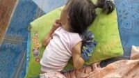 Anak 8 Tahun di Sukabumi Terbaring Sakit, Keluarga Keluhkan Tak Ada Perhatian Pemerintah