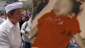 Dedi Mulyadi: Kasus Balita Raya di Sukabumi Jadi Alarm Gagalnya Layanan Dasar Pemerintah