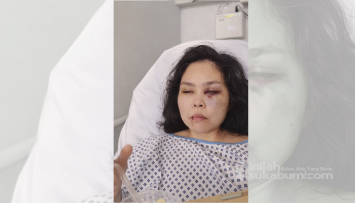 Viral di Medsos! PMI Asal Sukabumi Dirawat di Dubai, Diduga Disiksa Majikan